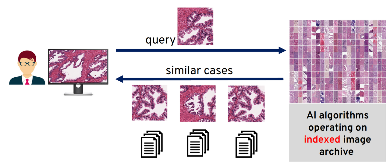 Pan-cancer diagnostic consensus through searching archival histopathology images using artificial intelligence