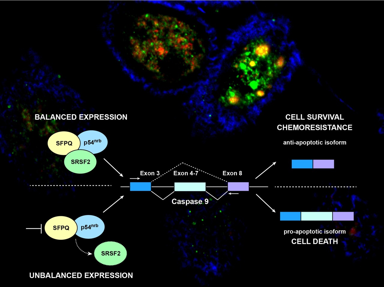 SFPQ regulates platinum-induced apoptosis in ovarian cancer