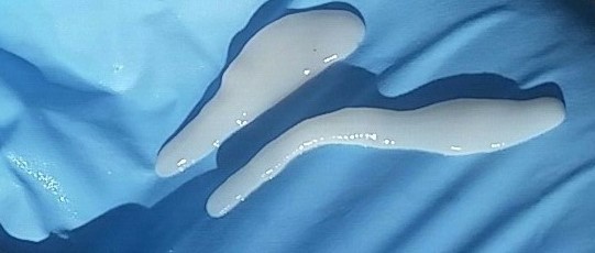 A Leaky Russian Doll: Discovery of Viruses in a Parasitic Worm and Transmission to Parasitized Hosts