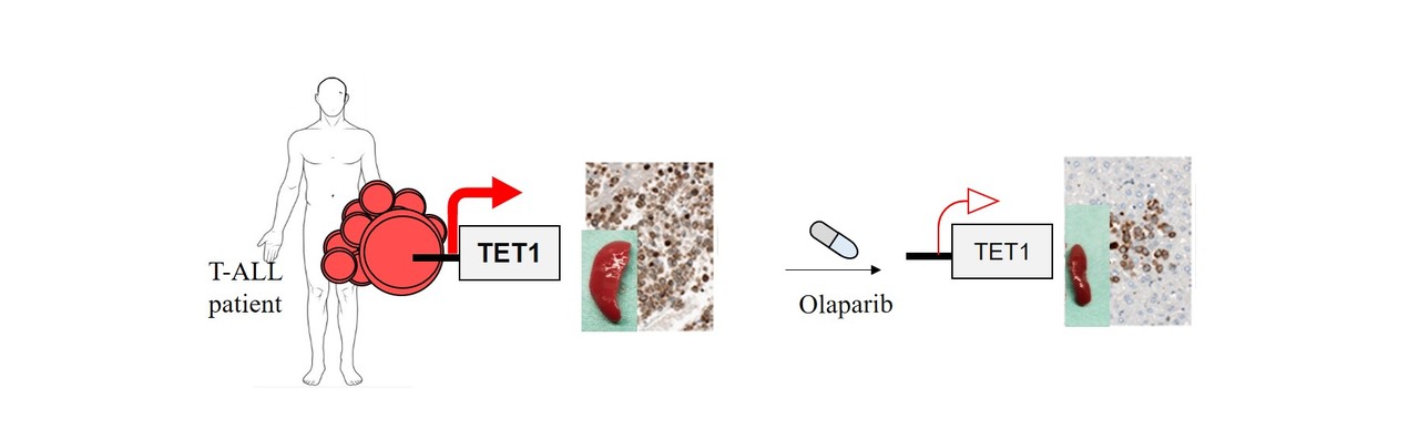 TET1 promotes growth of T-cell acute lymphoblastic leukemia and can be antagonized via PARP inhibition
