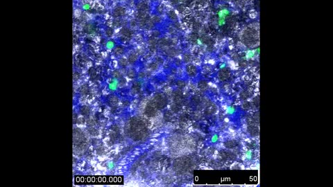 Dynamic passage of P. yoelli in the spleen