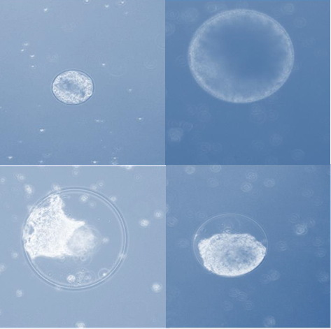 The promise of stemming cancer stem cells with miRNA modifiers 