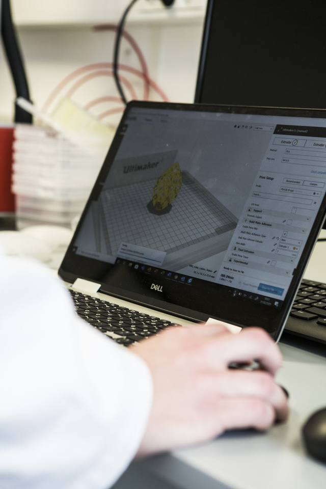 Tissue engineering for breast reconstruction