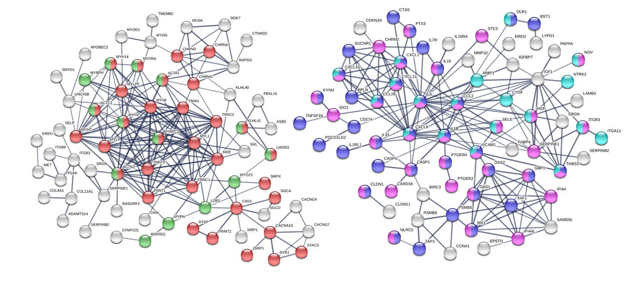 iPSC–Derived Progenitor Stromal Cells Provide New Insights into Aberrant Musculoskeletal Development and Resistance to Cancer in Down syndrome