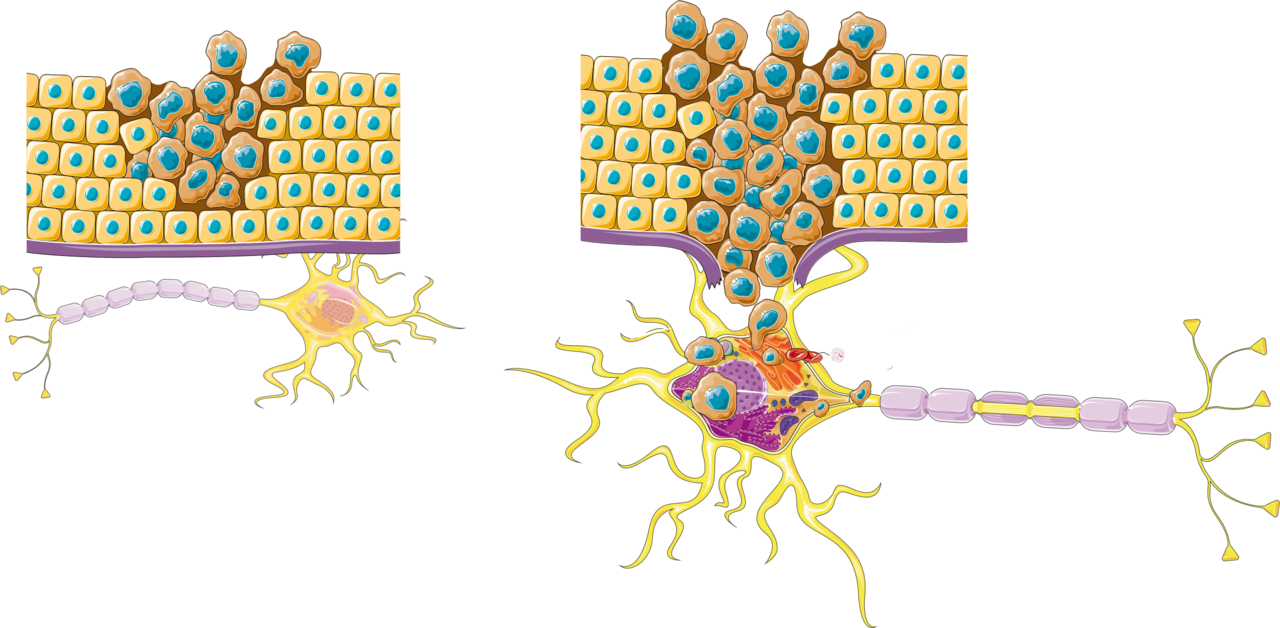 Nerve Fibres in the Tumour Microenvironment