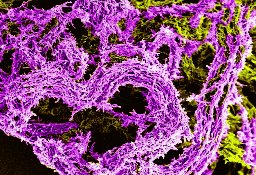 ‘Yes, it's true (yes, it's true),
I’m so happy to be stuck tubercule’