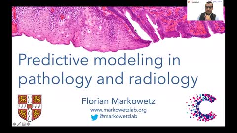 Florian Markowetz – Image analysis of the tumour tissue and early detection by AI