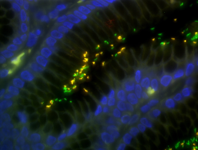 Population dynamics of clarithromycin-resistant Helicobacter pylori:
Searching for primary resistance
