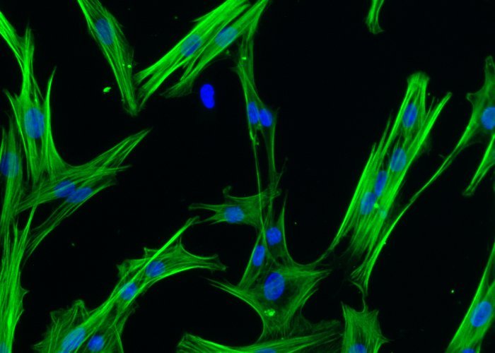 Heart fibrosis: the instance of persistence  