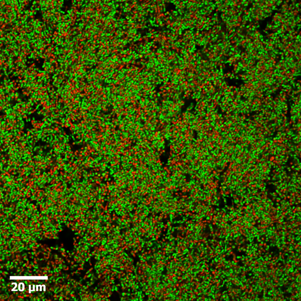 Biofilm Viability Checker: Creating a tool to calculate biofilm viability from confocal microscopy images