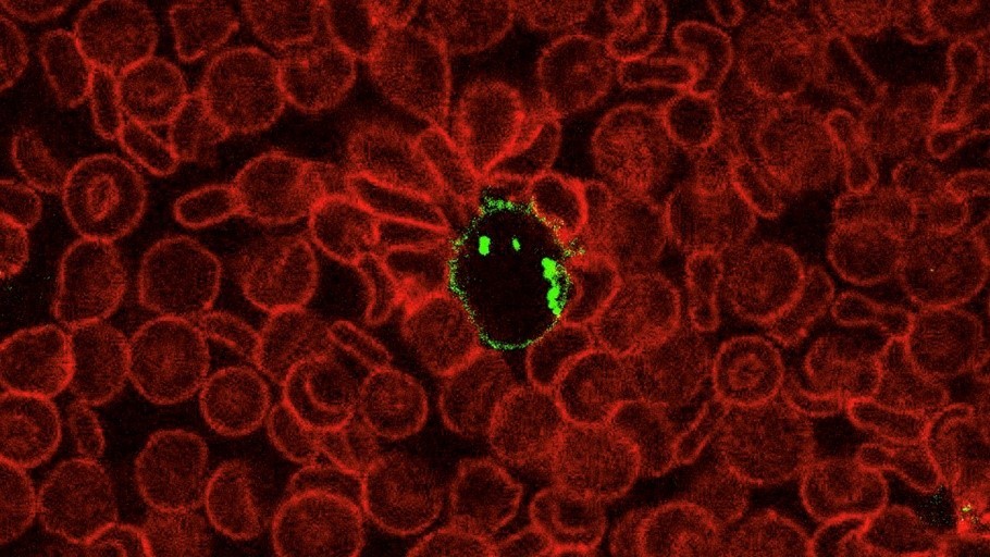 Allogeneic Engineered Red Blood Cells as an Anti-Tumor Therapeutic 