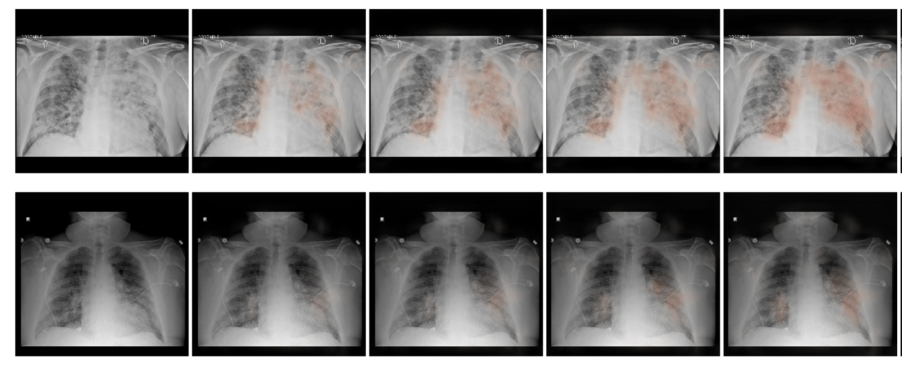 An artificial intelligence system for predicting the deterioration of COVID-19 patients in the emergency department