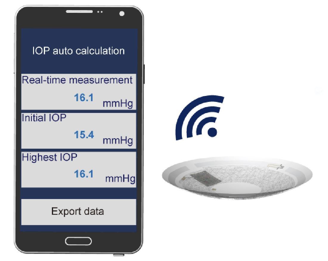 A soft, smart contact lens for monitoring of intraocular pressures