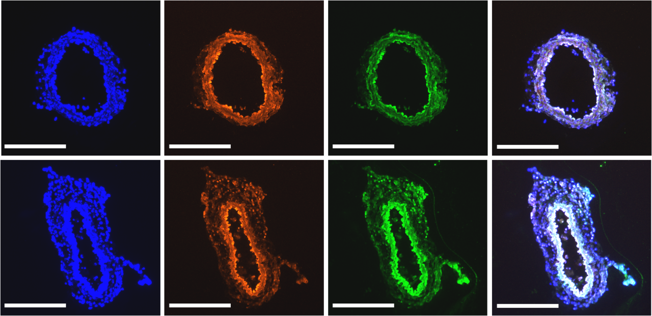 Targeting mechanosensitive cannabinoid receptor 1 with isoflavone prodrugs attenuates atherosclerotic endothelial dysfunction