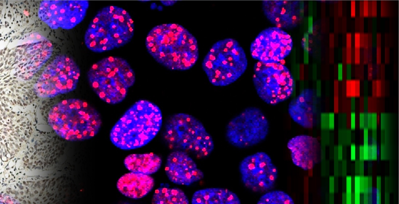 Dose matters: the role of Oct4 in the regulation of tumor radioresistance depends on its fine-tuned expression level