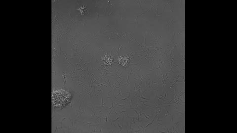 "Bacterial zorbing": A new mechanism for collective movement of biofilm-like microcolonies