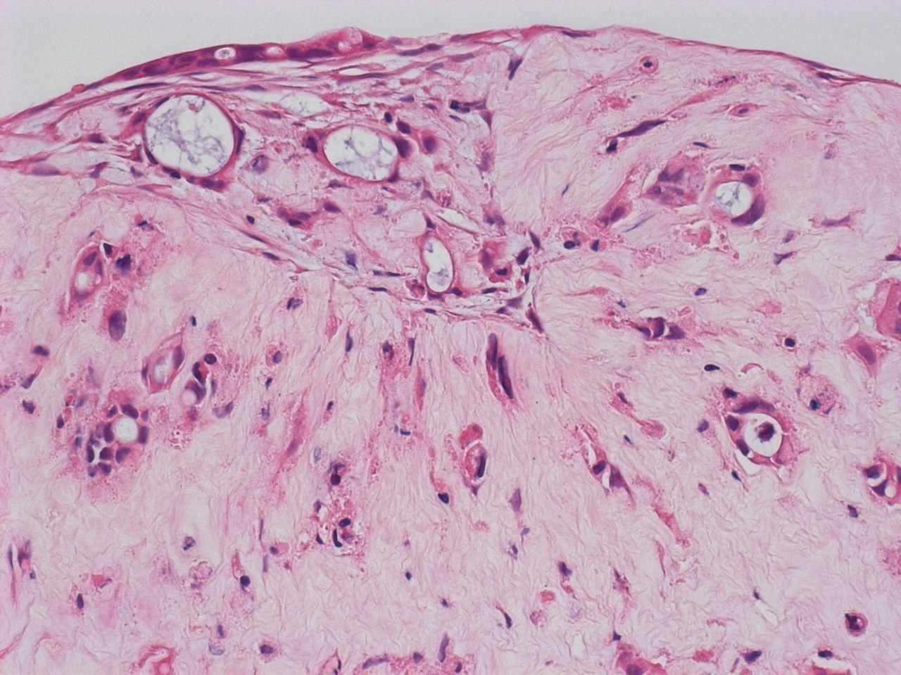 Reconstructing patient tumours to predict response