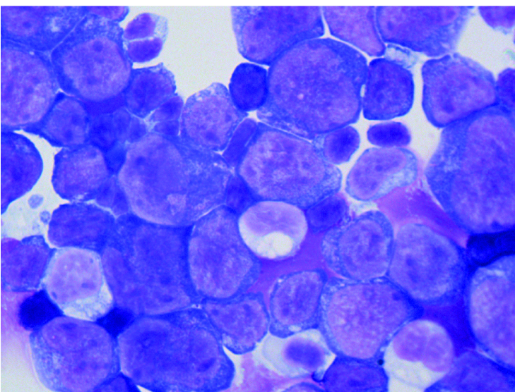 The tumor suppressor MIR139 is silenced by POLR2M to promote AML oncogenesis