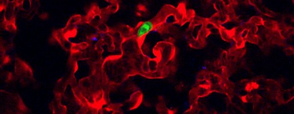 Primary tumor associated macrophages activate programs of invasion and dormancy in disseminating tumor cells.