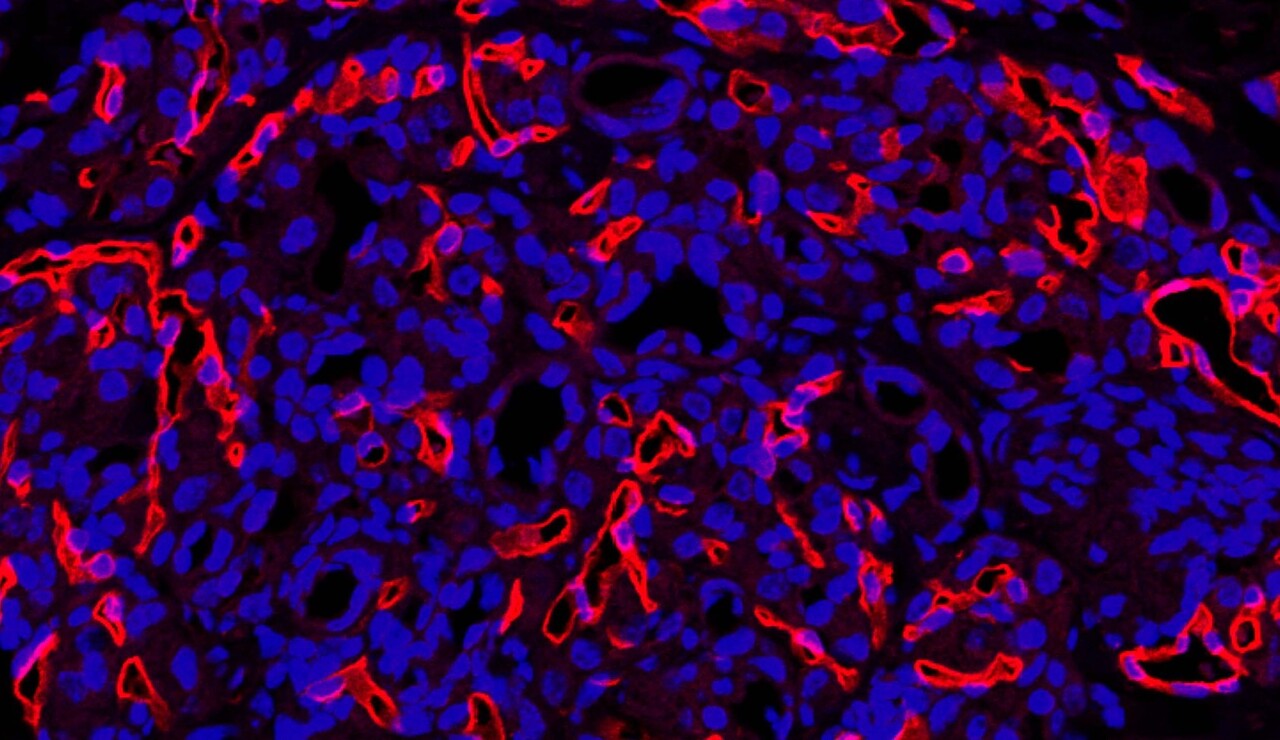 Peter Ratcliffe: "...I love discussing new data with lab members and planning new work."