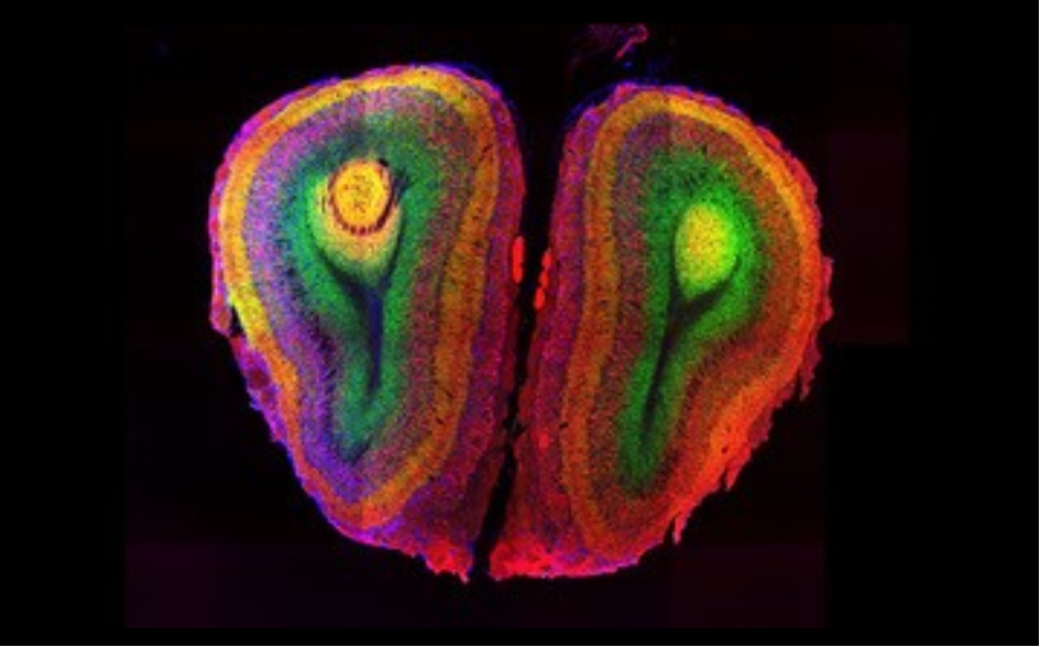 Mathias Uhlen: "A large part of the cutting-edge research in biology and medicine is technology..."