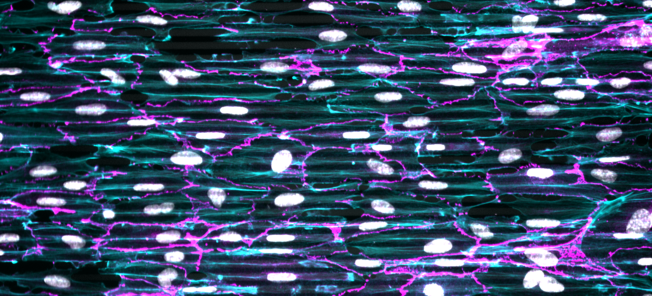 Collective movement of vascular endothelial cells on microgrooved substrates viewed as the flow of an active fluid