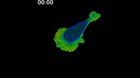  Gallery | A human breast cancer cell immediately shifts its shape at high viscosity