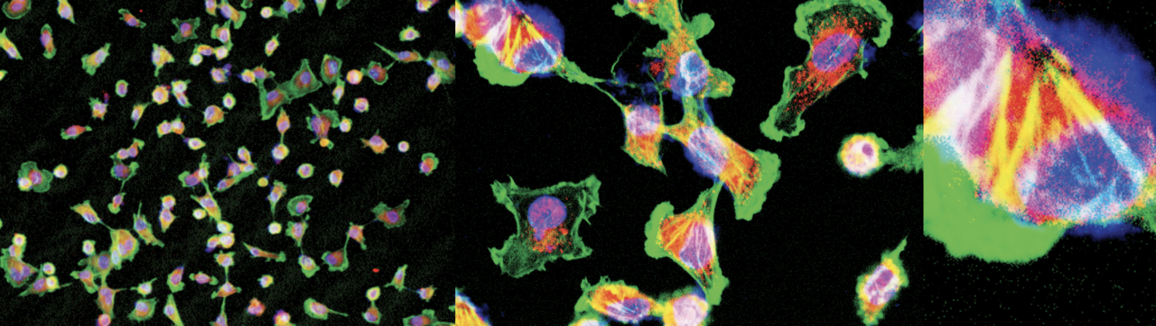 BRAF activation by metabolic stress promotes glycolysis sensitizing NRASQ61-mutated melanomas to targeted therapy