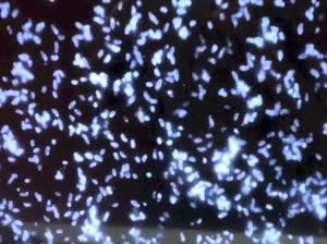 Cholera movie, Wellcome Collection