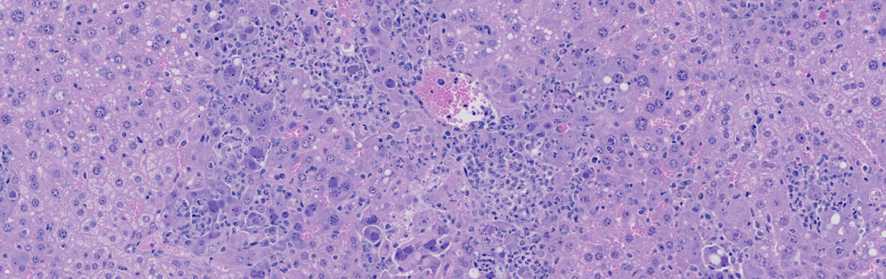 From Signal to Surge: How TNFα/TNFR2 Axis Supercharges NK Cell Activity