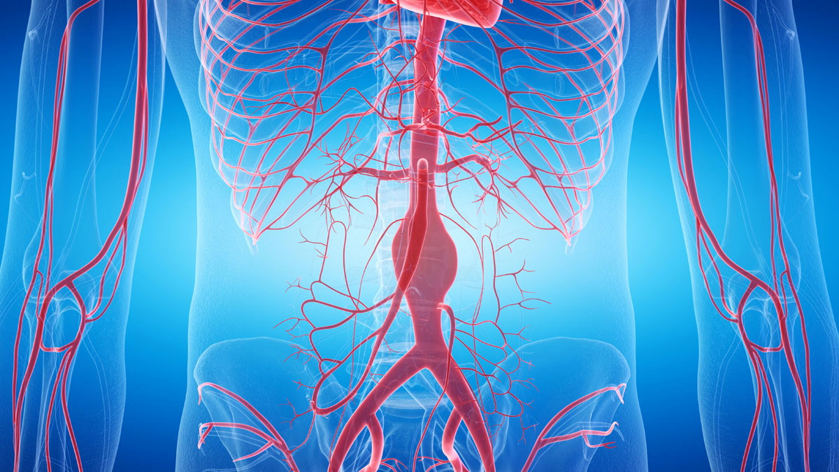 Your space to connect: The Aortic aneurysm and dissection management Hub  