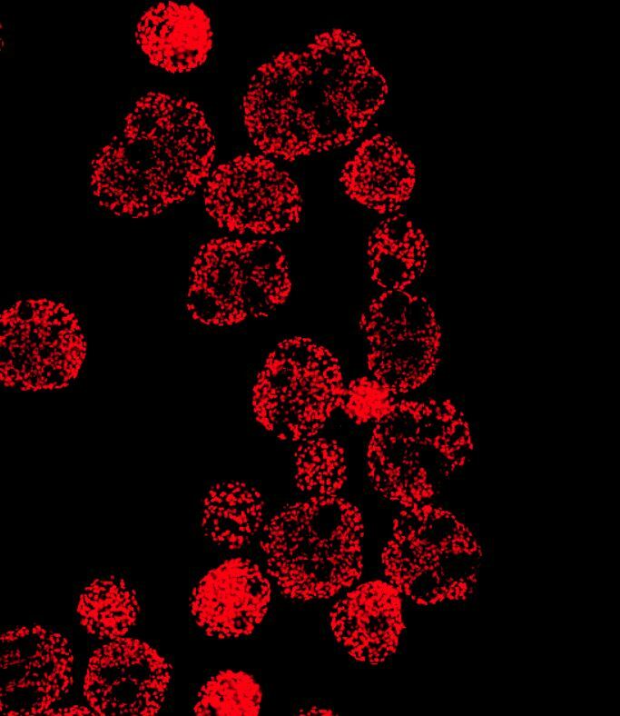Mastering Cardiomyocyte Production: From Complex Bioreactors to Scalable Spinner Flask Systems