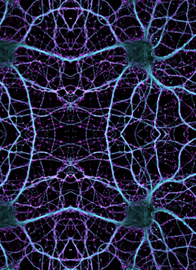 Optimising the Functionalisation of Alginate Hydrogels for Three-dimensional Astrocyte Culture Systems - Poster 