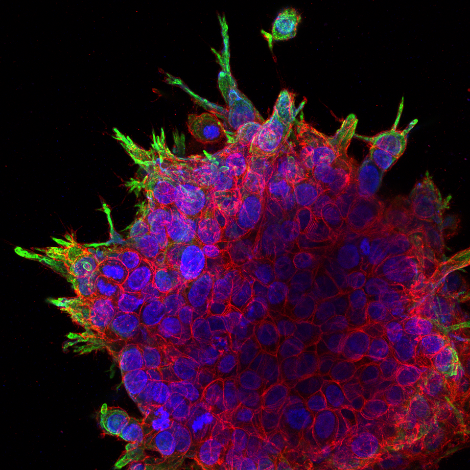 Deciphering molecular programs that govern collective and single cell invasion in head and neck cancer