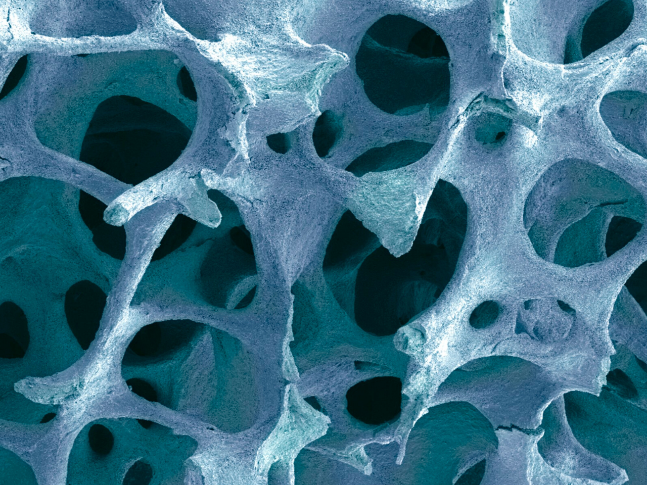 Остеопороз микропрепарат. Trabecula bone marrow. Костная ткань микрофотография. Губчатая костная ткань под микроскопом. Костная ткань микроскоп 10x.