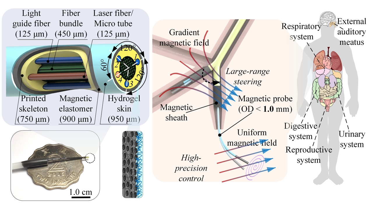 The revolutionized management for bodily narrow channel diseases: fiberscopic robot