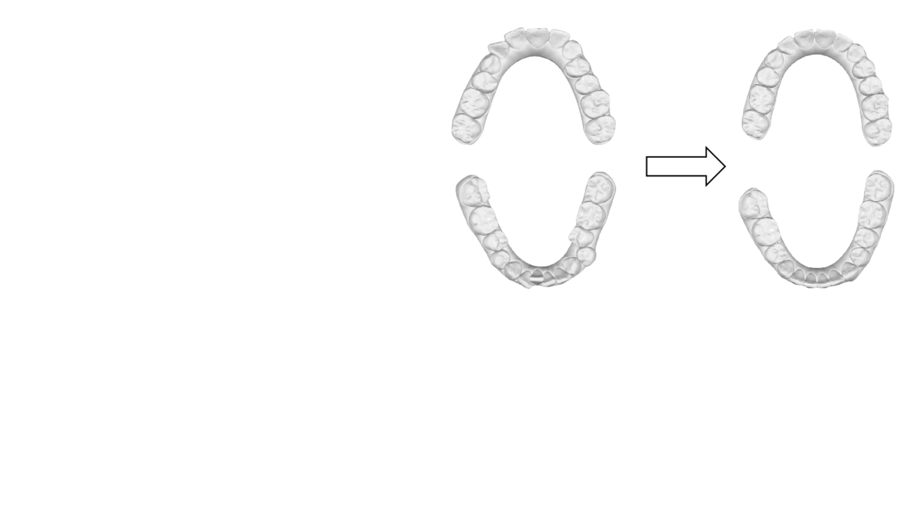 A 3D dental model dataset with pre/post-orthodontic treatment for automatic tooth alignment
