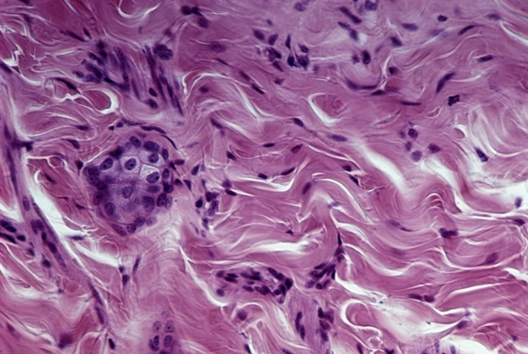 Call for papers: Fibrosis: Tissue Repair and Remodelling