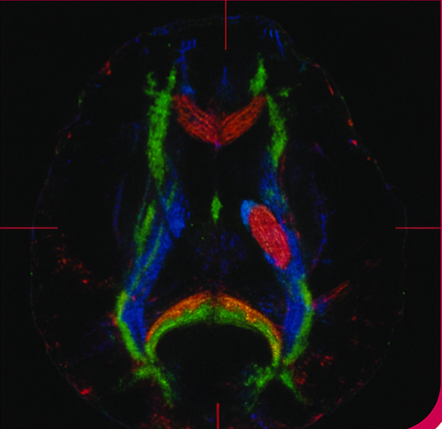Introducing Translational Stroke Exchange