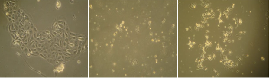 Targeting liver cancer stem cell through EpCAM therapy targeted with chemotherapy endorse enhanced progression in hepatocellular carcinoma