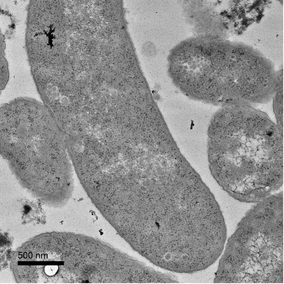 Breaking balance – how Bilophila wadsworthia turns rogue