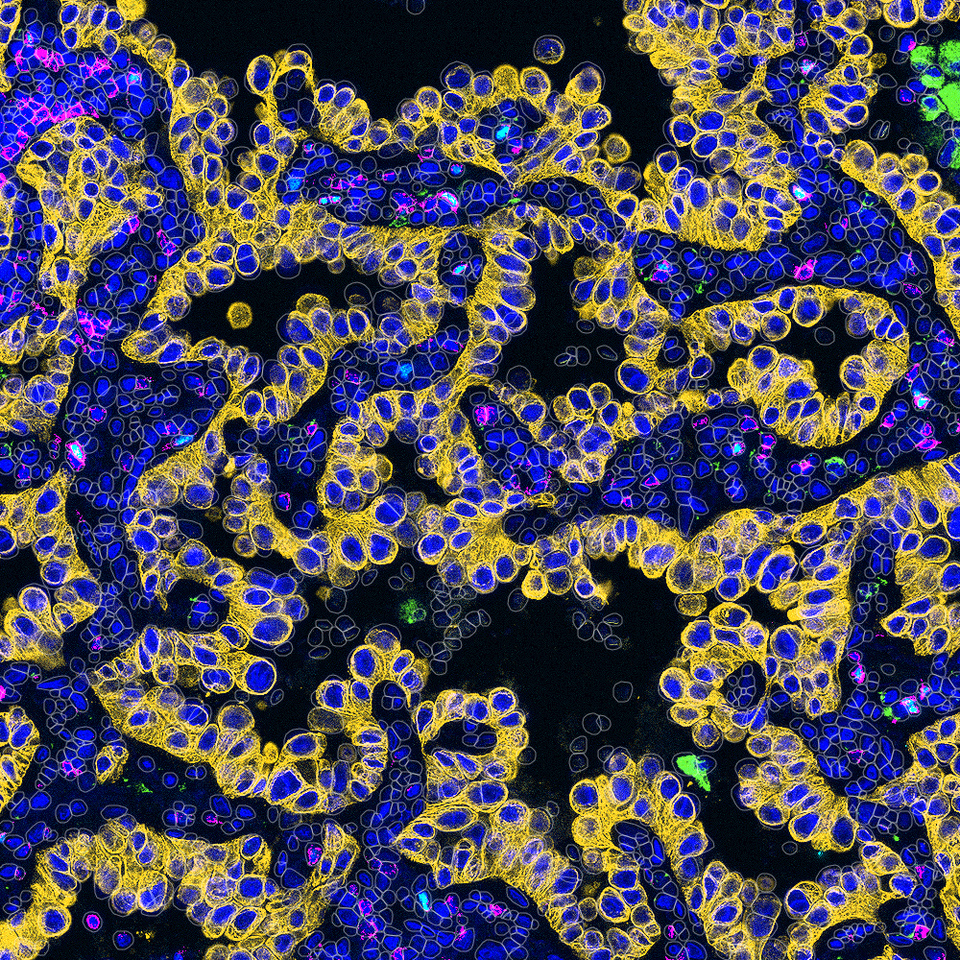 Squinting at Stains, Scaling with Code: Building MARQO for Multiplex Mastery