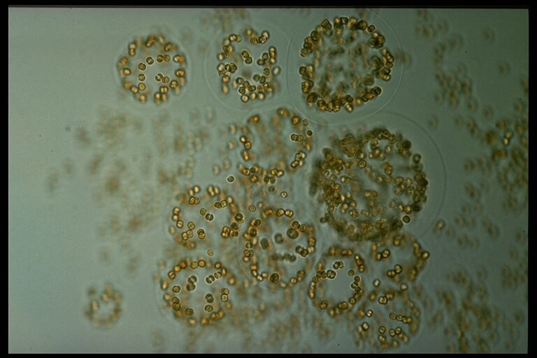 Ancient DNA Reveals Carbon Drawdown by Algal Blooms During the Antarctic Cold Reversal