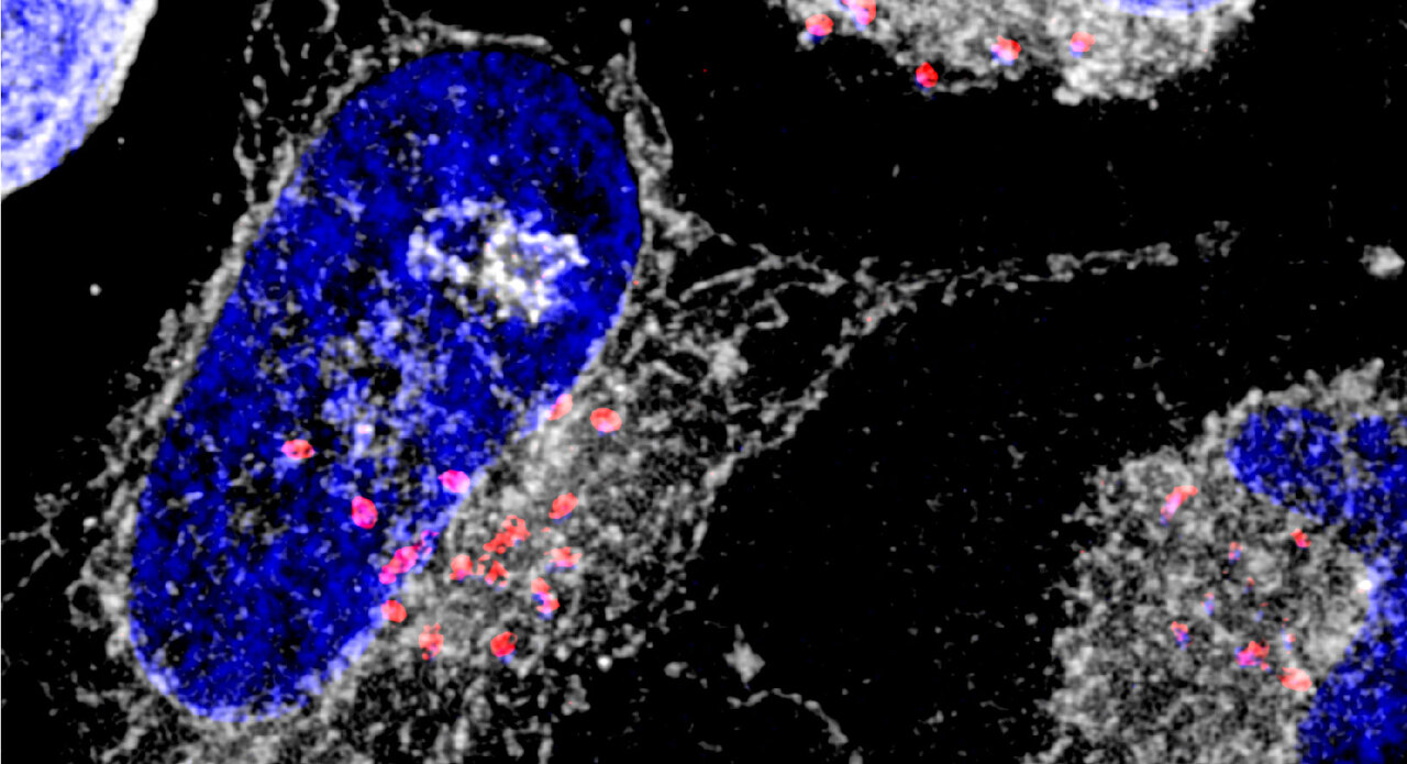 p53 under siege: A novel strategy of immune evasion by an intracellular pathogen