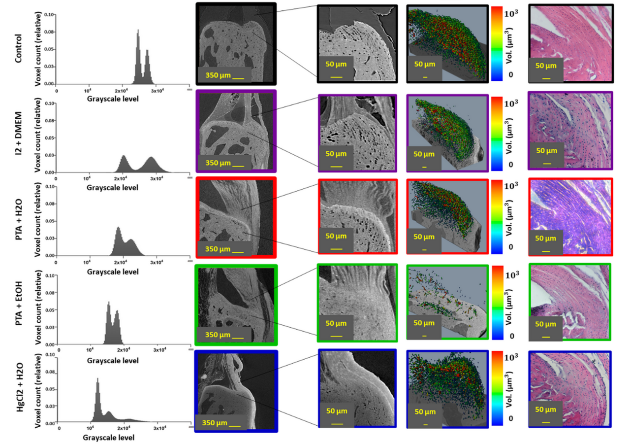 Evaluating the Impact of Contrast Agents on the Mechanics of the Tendon-Bone Interface