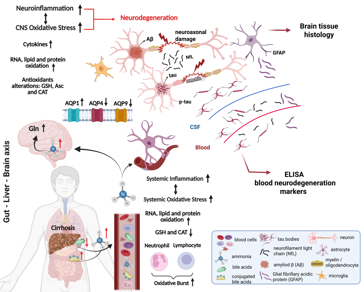 Liver dysfunction triggers early Alzheimer’s pathology in an adult rat model of chronic liver disease