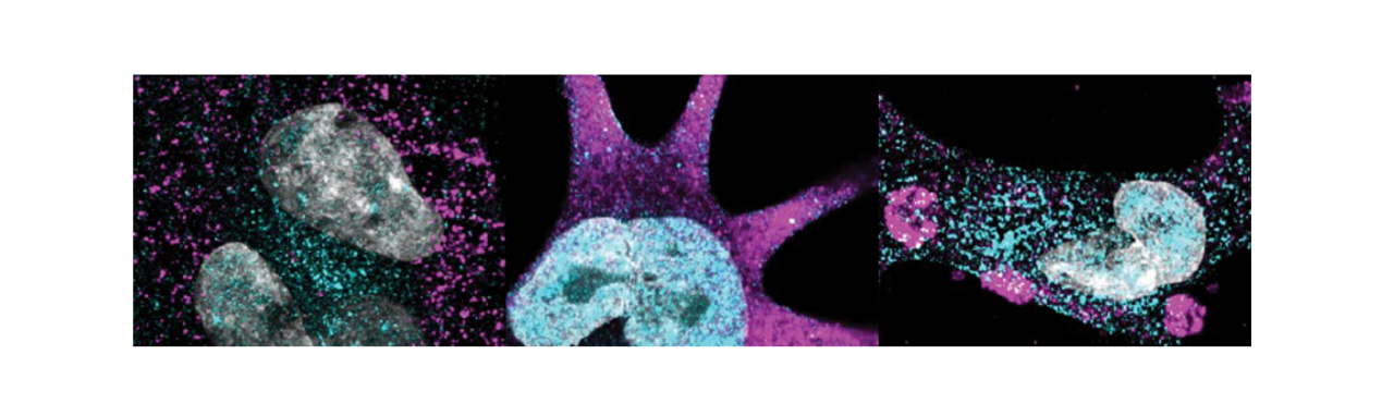 Behind the paper: Tracing a heart disease mutation to the kidney
