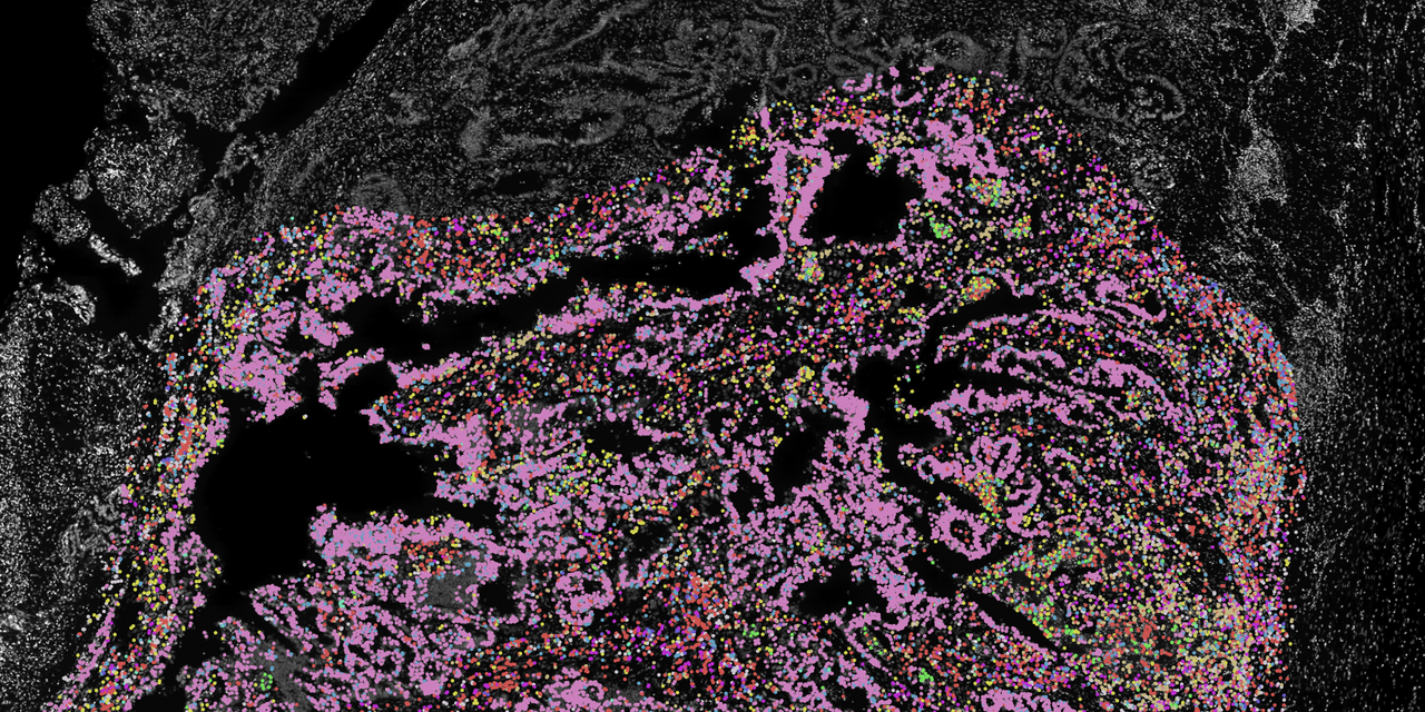 When Cancers Outsmart the Immune System from the Very Beginning