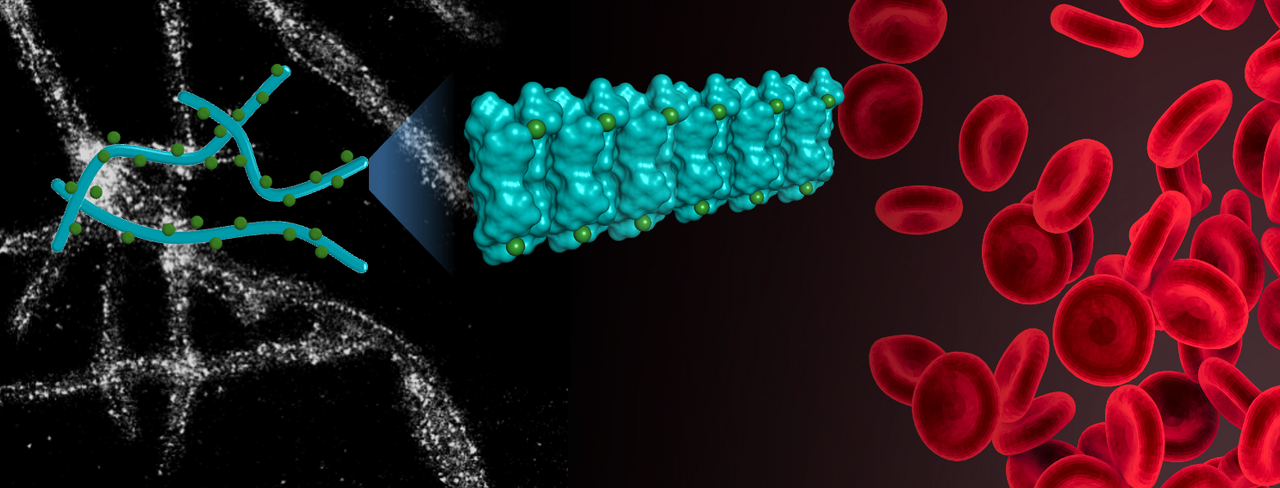 Engineering oat protein nanostructure to combat iron deficiency anemia
