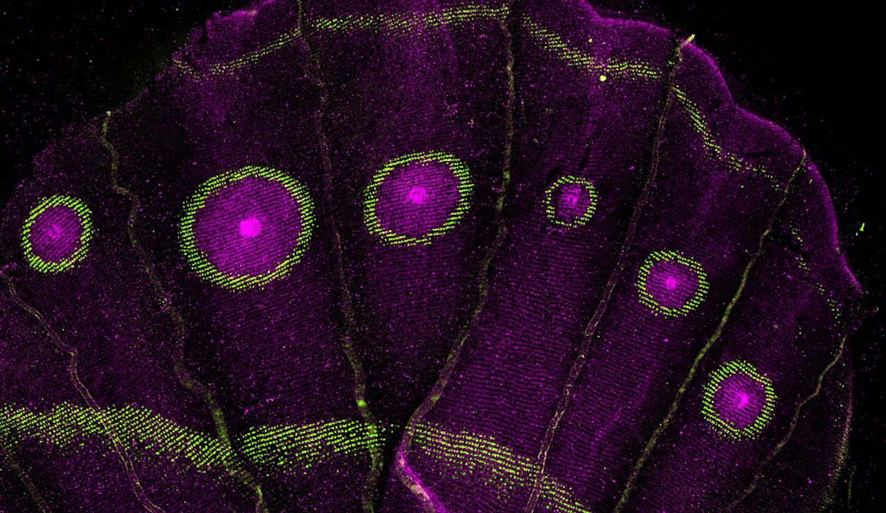 An ancient gene network repurposed to paint butterfly eyespots